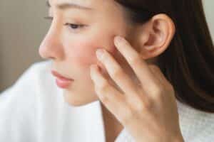 A young woman examines her reflection in the mirror, noticing a red facial rash caused by a cosmetic allergy and skin irritation.
